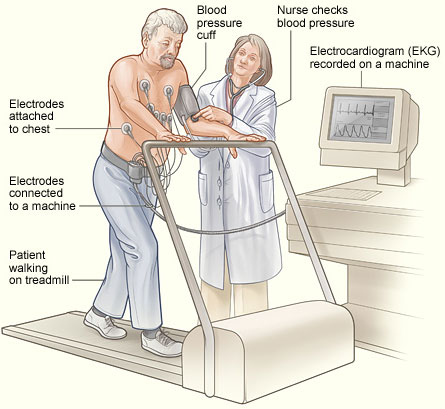 Exercise Treadmill Test