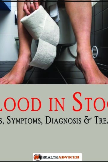 blood in stool