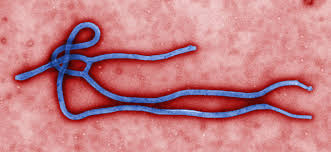 Ebola Virus