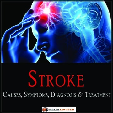 stroke brain