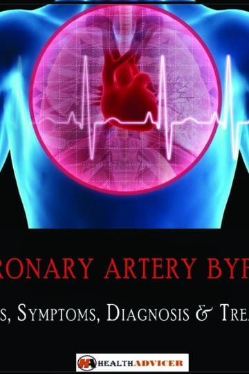 Coronary artery bypass