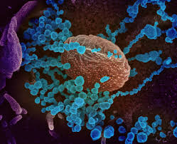 How Long Does The Coronavirus Last On Surfaces