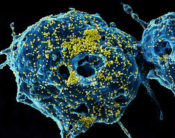 Middle East respiratory syndrome