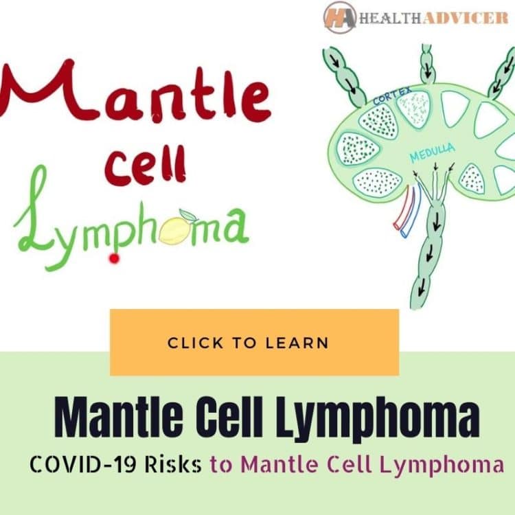 COVID-19 Risks When You Have Mantle Cell Lymphoma