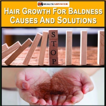 Hair Growth For Baldnes