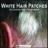 White Hair Patches