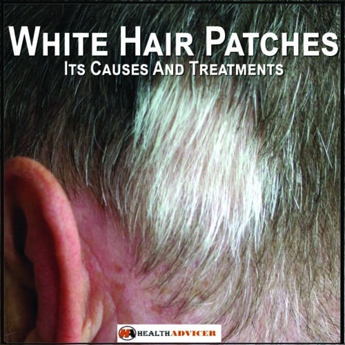 White Hair Patches Its Causes And Treatments