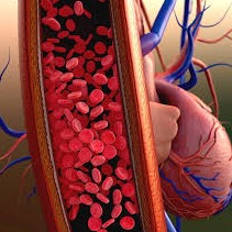 Coronavirus and High Blood Pressure