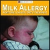 Milk Allergy