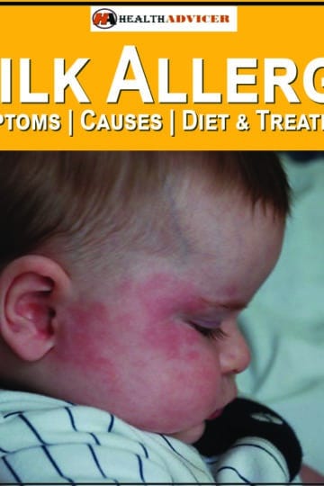 Milk Allergy