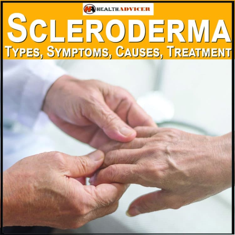 Scleroderma