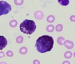 Mast Cells