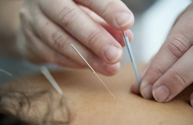 Acupuncture To Ease Shortness Of Breath During Pregnancy