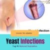 Natural Remedies for Yeast Infections